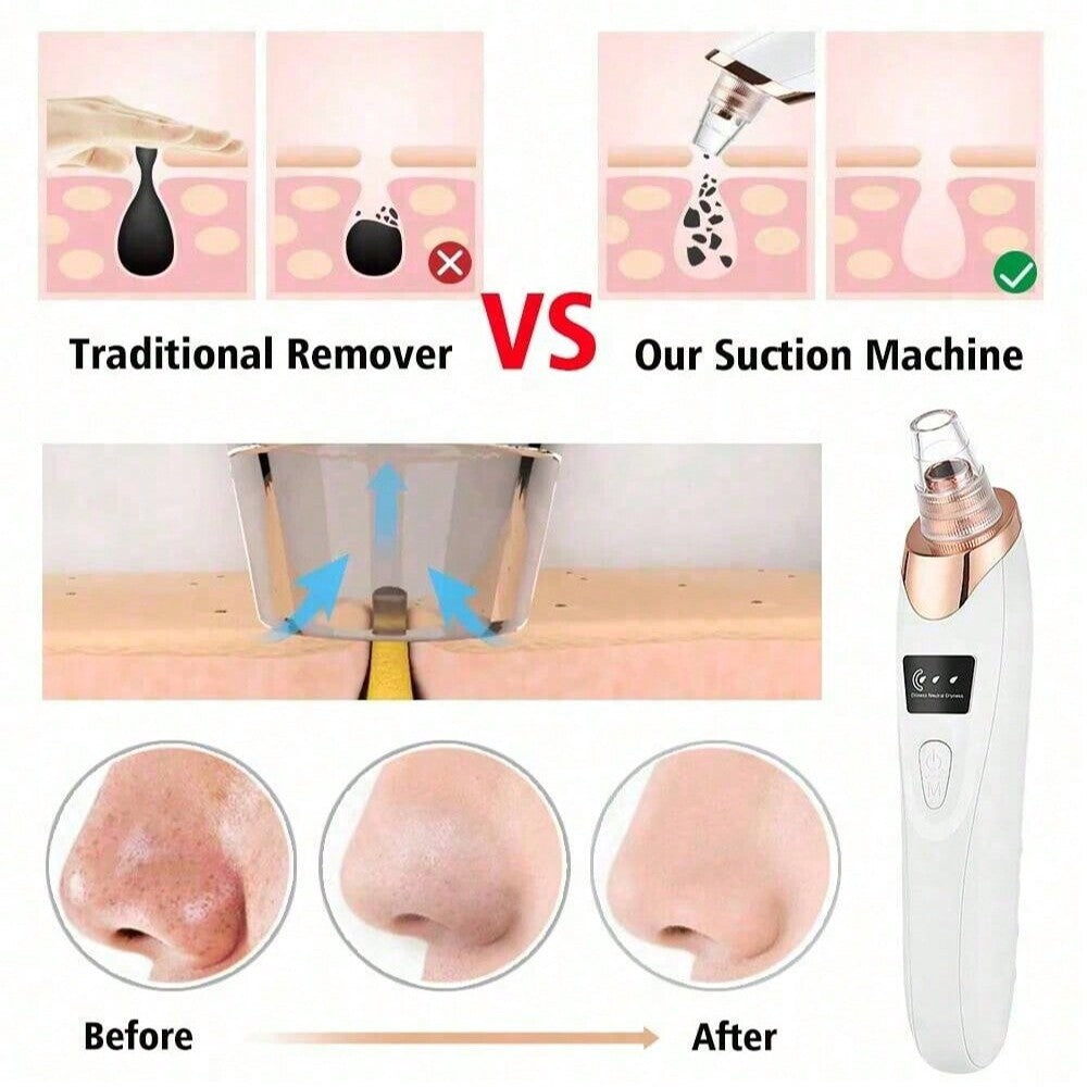 SILK STREET™– Electric Acne Pore Cleaner & Blackhead Remover